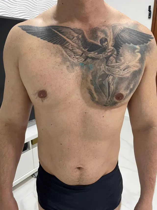 Antes